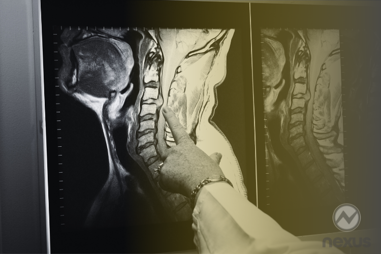 Telerradiologia subespecializada